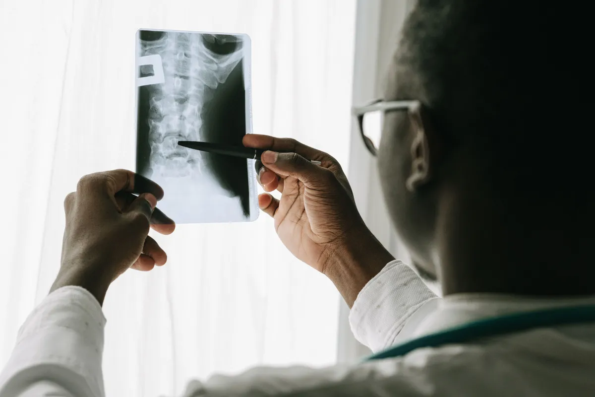 A clinician in a white coat holding an X-ray film up to the light and pointing at it with a pen